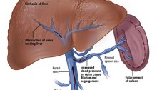 liver vena