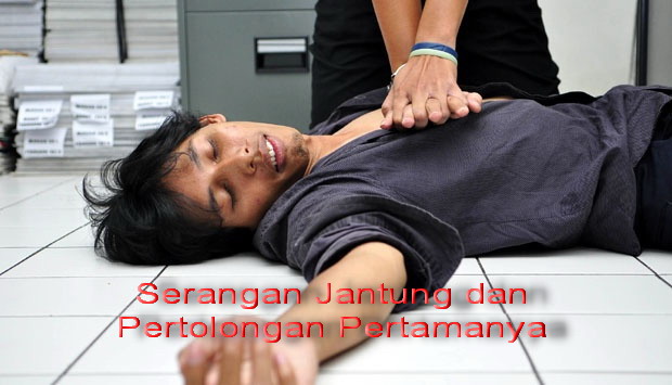 serangan jantung