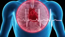 Angioplasty: Coronary Artery Disease Treatment